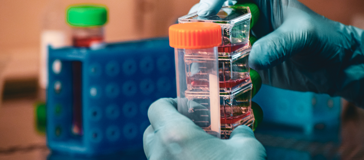 A close-up of gloved hands holding a clear multi-compartment sample vial with an orange cap, with a blue rack and more test tubes blurred in the background.